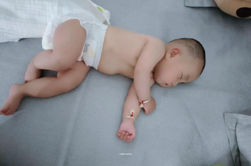 兴化六个月宝宝眼睛散光